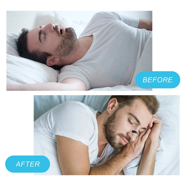 Magnetic Snore Stopper